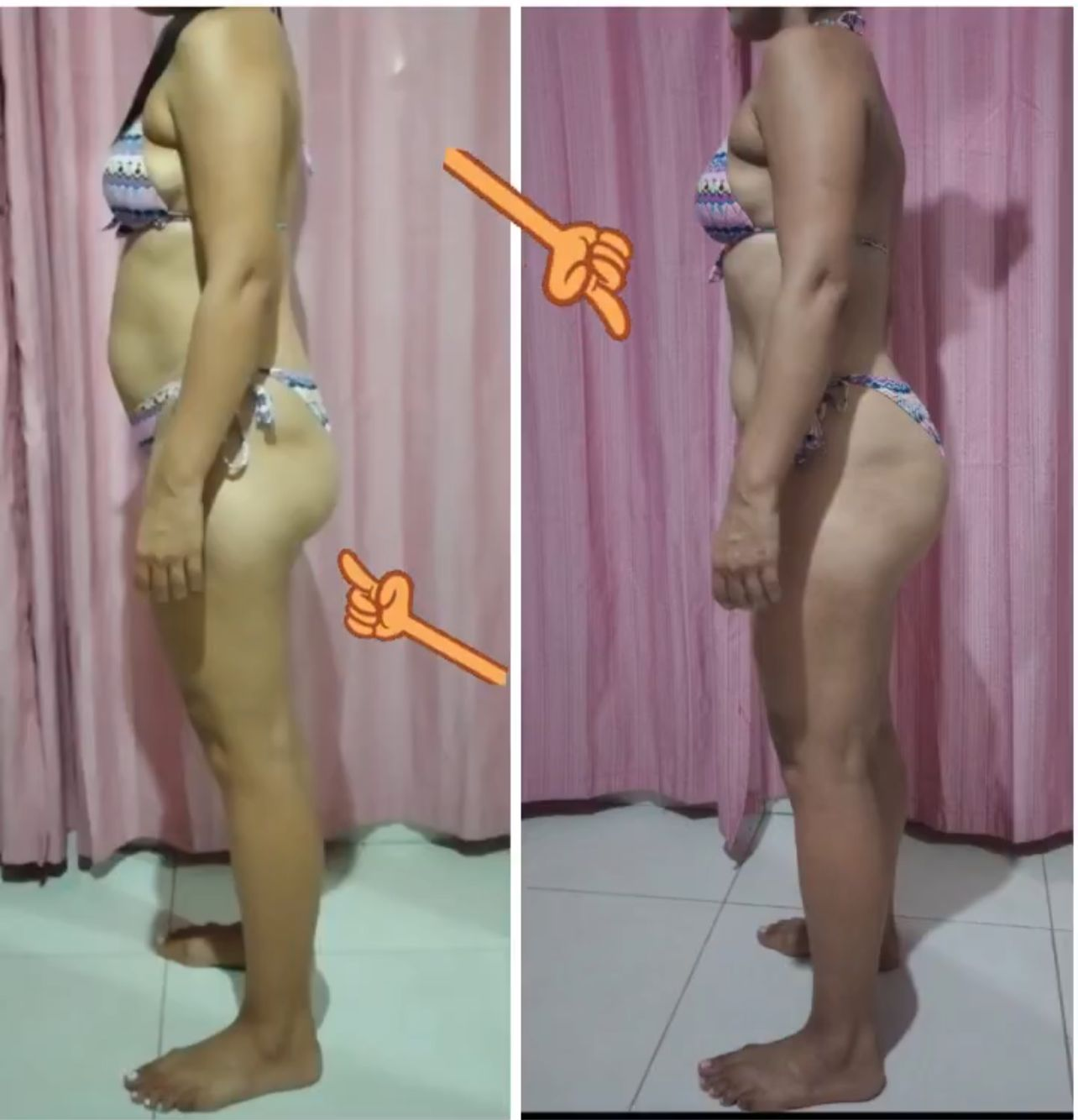 Evolução Antes e Depois